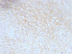 CD59 Antibody (MACIF/629), Novus Biologicals 0.2mg; Unlabeled:Antibodies,